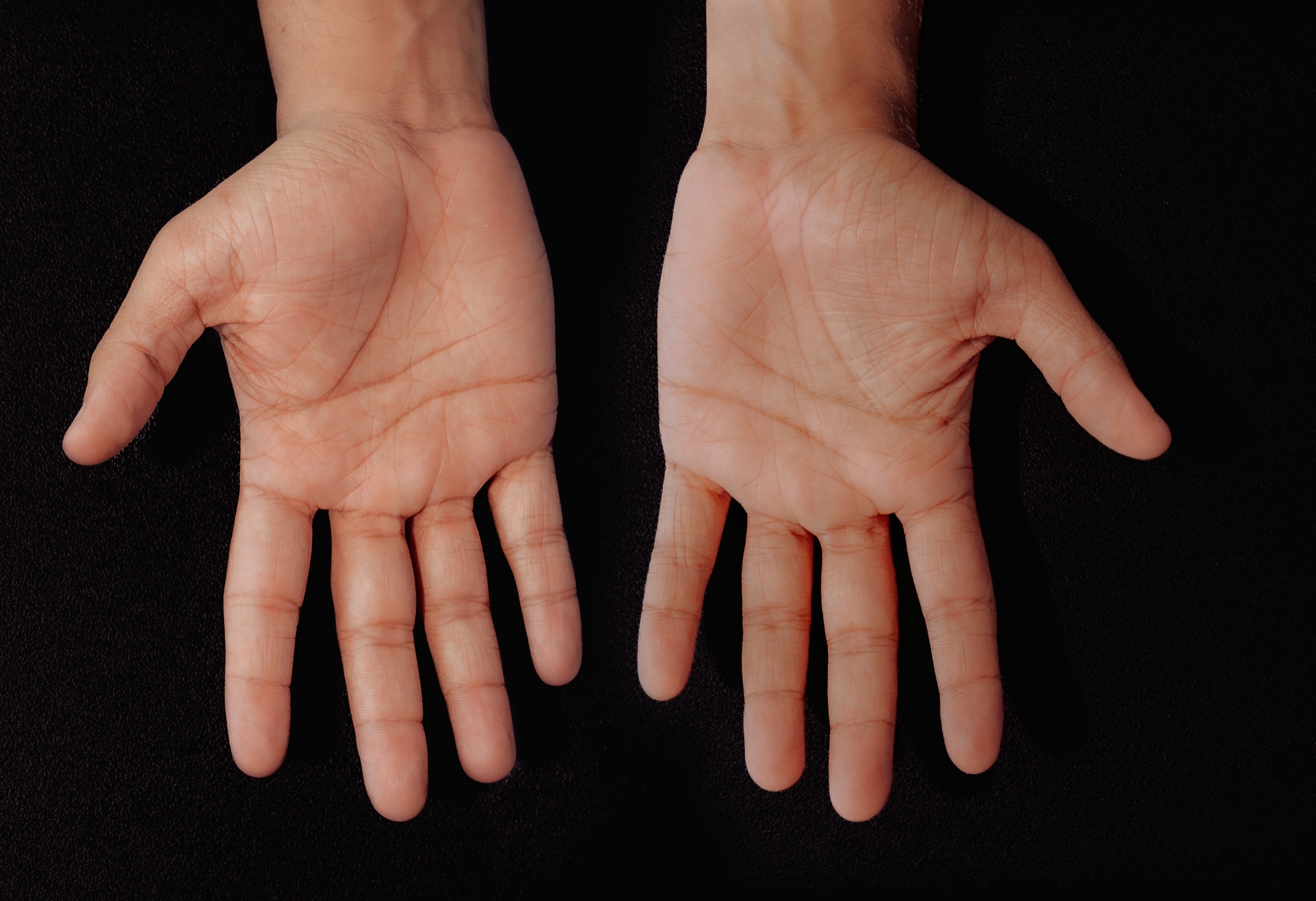 agni fisioterapia 04