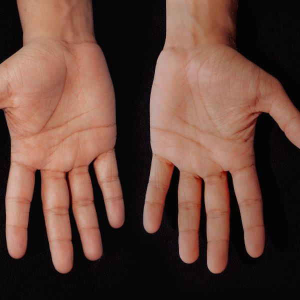 agni fisioterapia 04