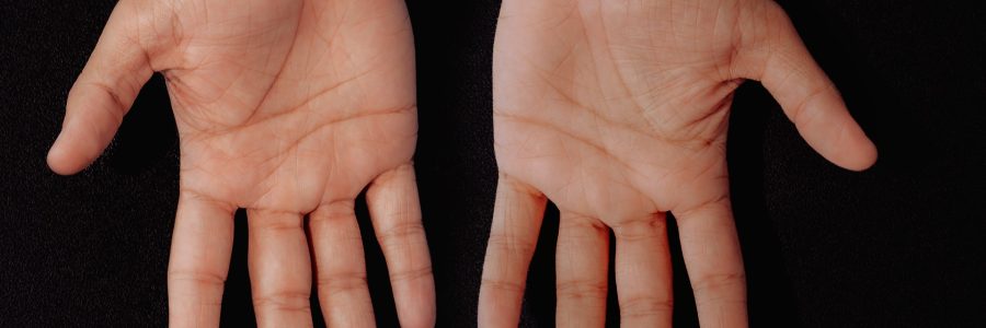 agni fisioterapia 04